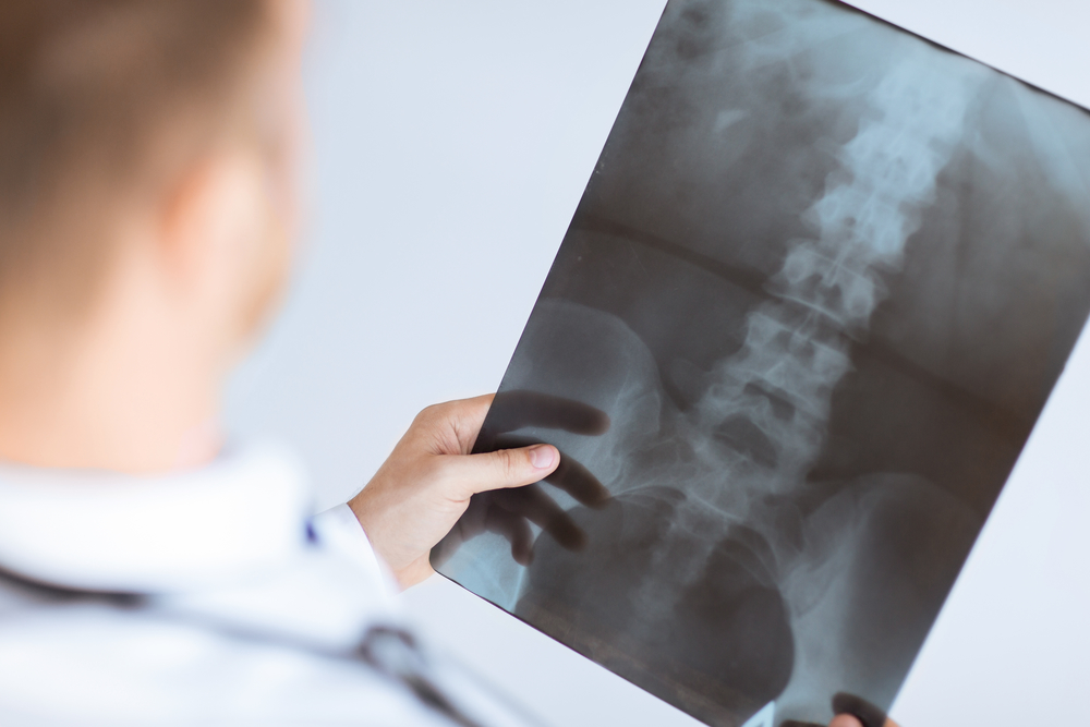 Reasonable Accommodations for Disabled Workers - doctor holding x-ray or roentgen image